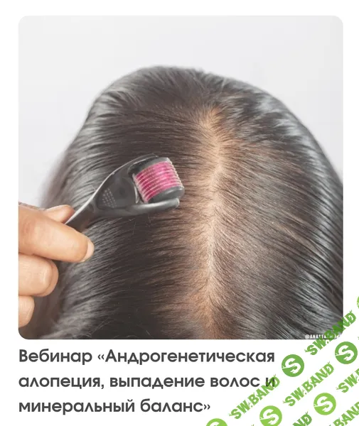 [Анастасия Семко] Андрогенетическая алопеция, выпадение волос и минеральный баланс (2026)